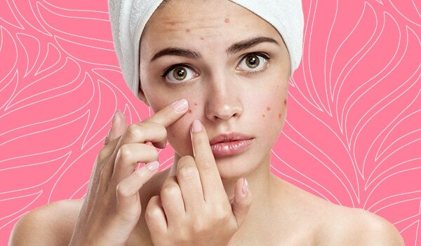An Expert’s Guide On How To Deal With Pcos Related Skin And Hair issues