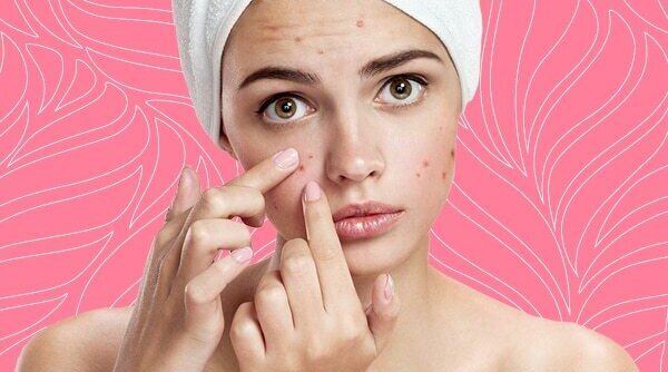 An Expert’s Guide On How To Deal With Pcos Related Skin And Hair issues