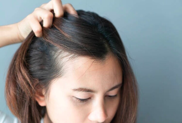 Simple Solutions For Thinning Hair Woes
