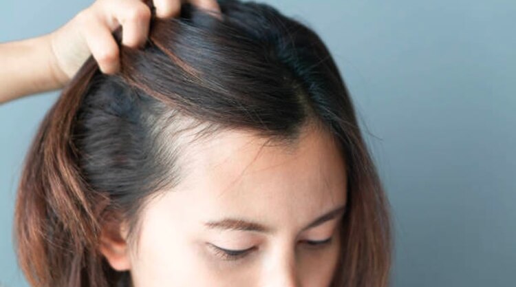 Simple Solutions For Thinning Hair Woes