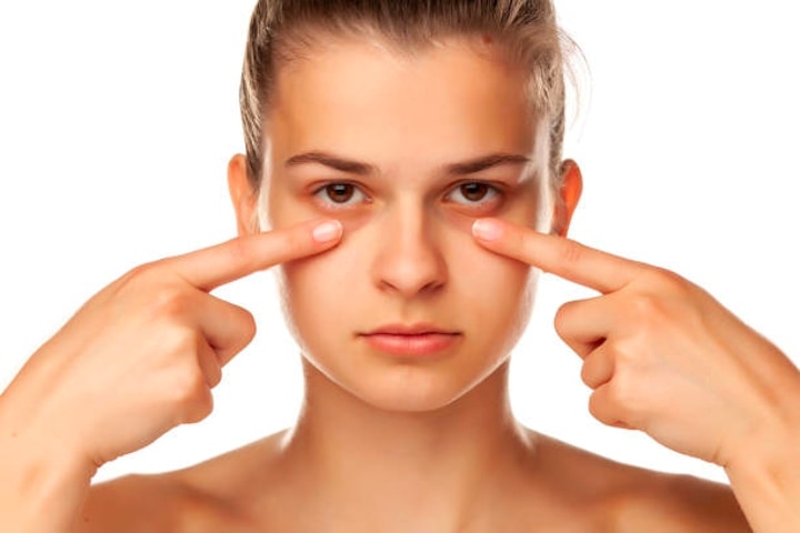 How To Remove Dark Circles: Top Techniques And Remedies