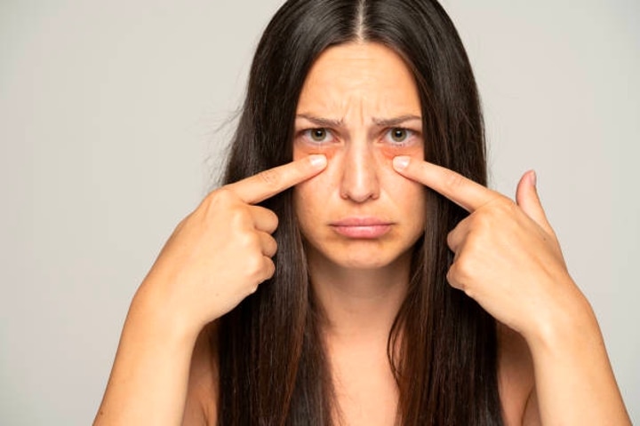 Concealing Dark Circles with Makeup
