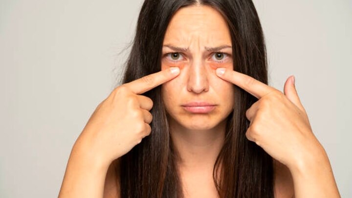 Concealing Dark Circles with Makeup