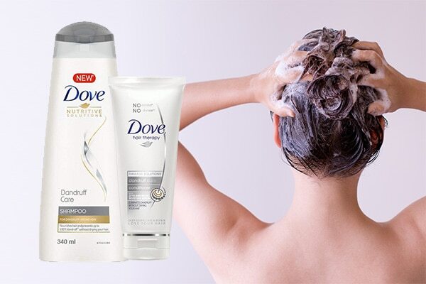 Ways to combat dandruff in summer