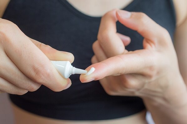 FAQs about get rid pimples