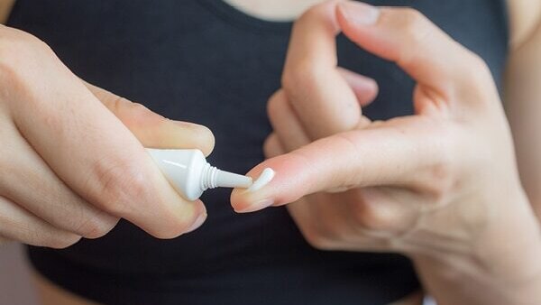 FAQs about get rid pimples