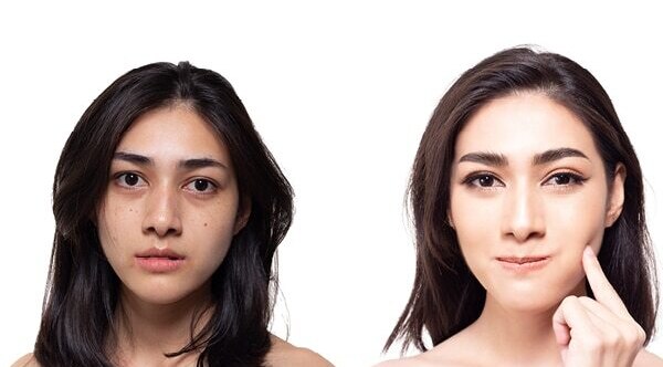 FAQs on diamond facials: