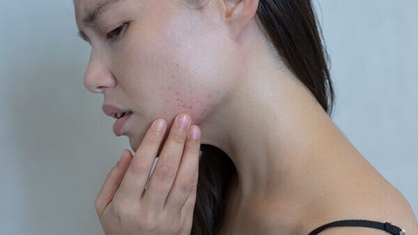 FAQs on diamond facials: