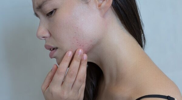 FAQs on diamond facials: