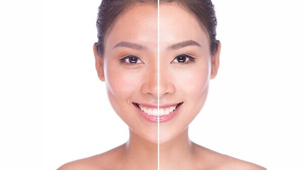 FAQs on diamond facials: