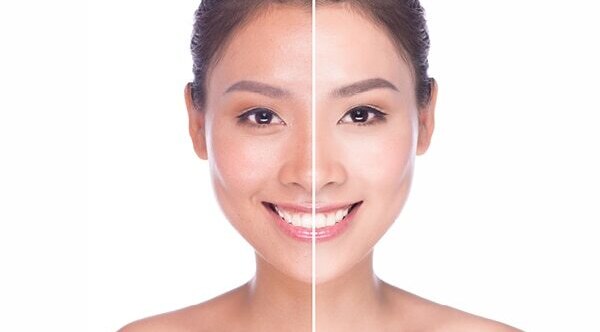 FAQs on diamond facials: