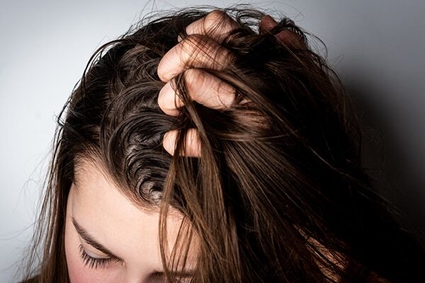 FAQs about greasy hair