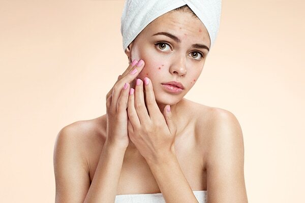 Step 6: Acne spot treatment