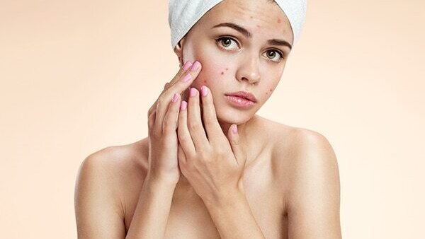 Step 6: Acne spot treatment
