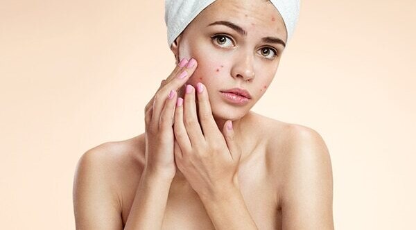 Step 6: Acne spot treatment