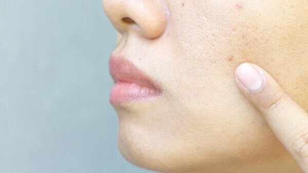 Prevents signs of ageing