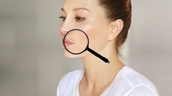 FAQs about electrolysis hair removal