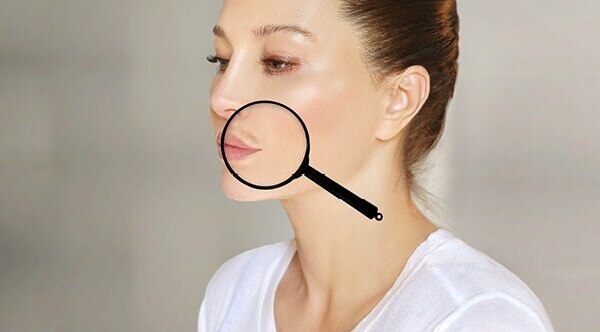 FAQs about electrolysis hair removal