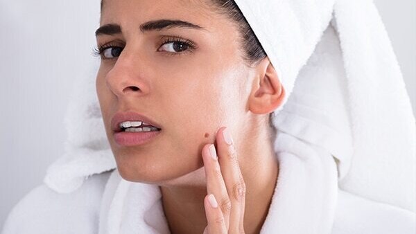 Your skin is getting thinner
