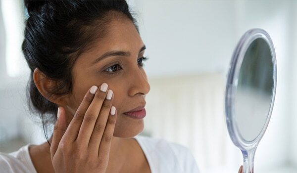 How To Prevent Pimples From Coming Back Every Now And Then