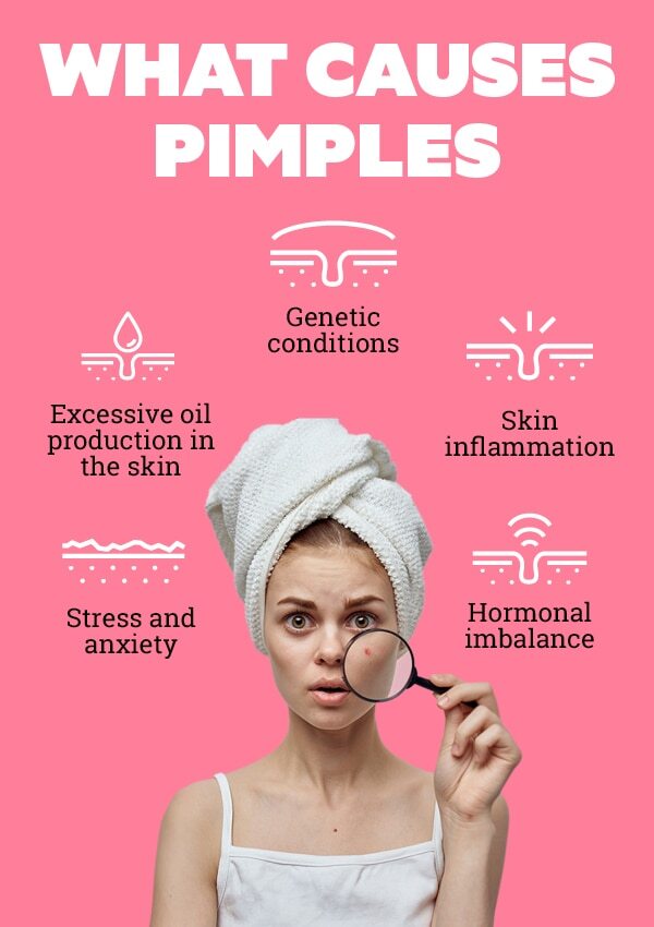 Cinnamon and honey for pimple free skin