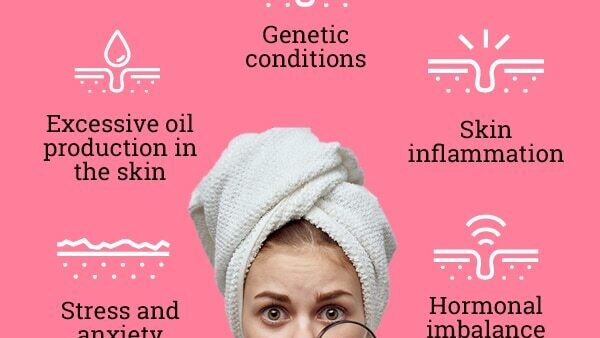 Cinnamon and honey for pimple free skin