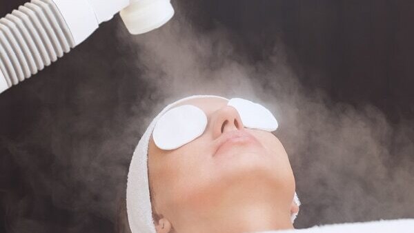FAQ on how to prevent pimples