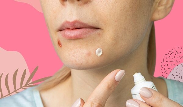 Does Toothpaste Get Rid Of Pimples