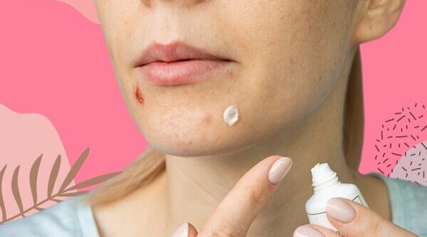 Does Toothpaste Get Rid Of Pimples