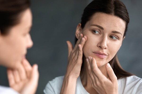 Home remedies for acne