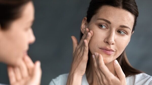Home remedies for acne