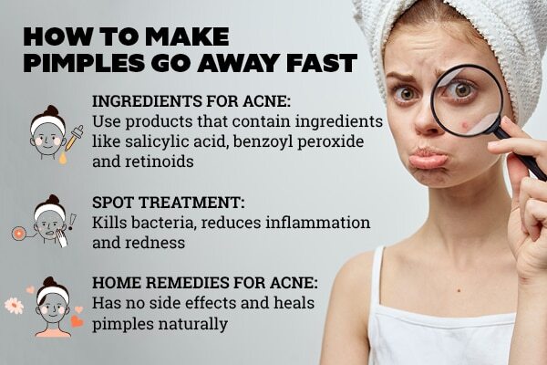 Home remedies for acne