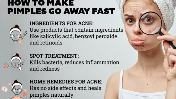 Home remedies for acne