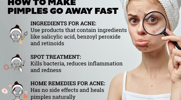 Home remedies for acne