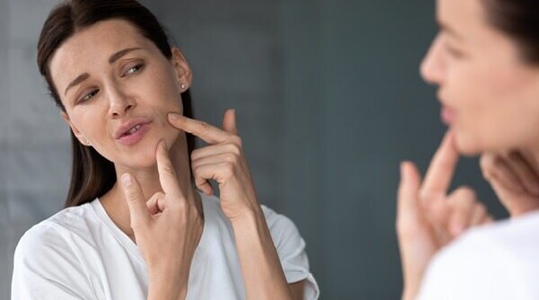 A Dermatologist’s Guide On Treating JawlineAcne