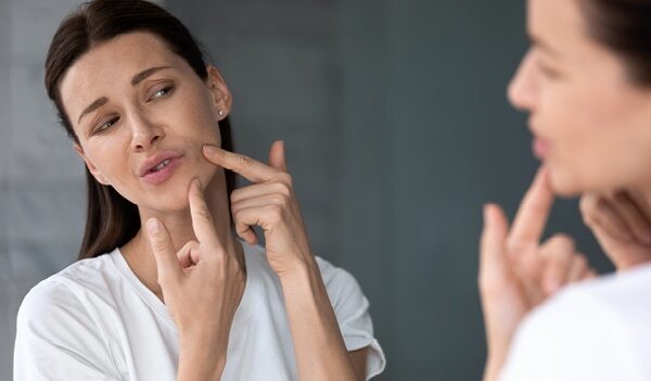 A Dermatologist’s Guide On Treating JawlineAcne