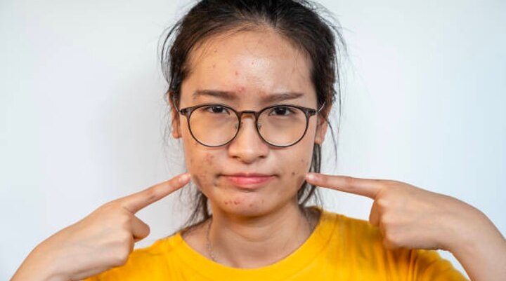 Beyond Cleansing: A Comprehensive Skincare Guide For Oily Skin