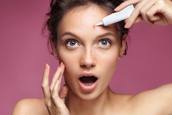 FAQs about jawline acne