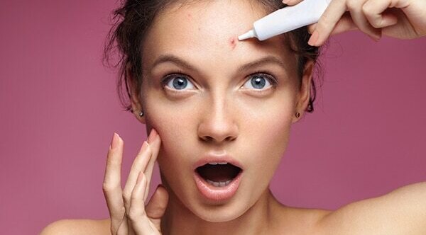 FAQs about jawline acne