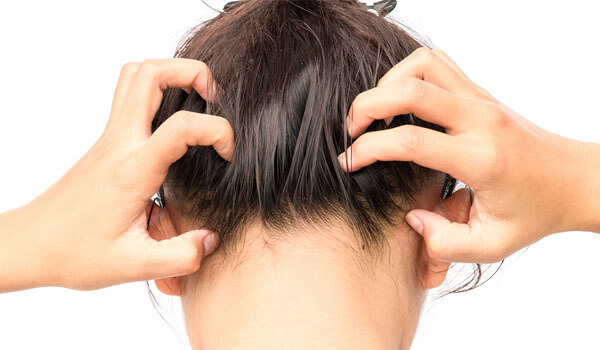 Why Dandruff Gets Worse In The Winter And How To Fight It