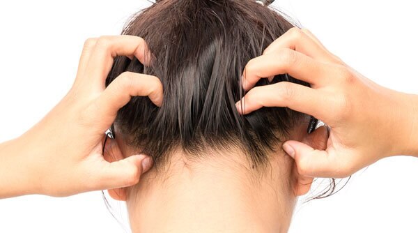 Why Dandruff Gets Worse In The Winter And How To Fight It