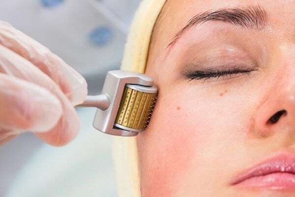 FAQs about dermaroller