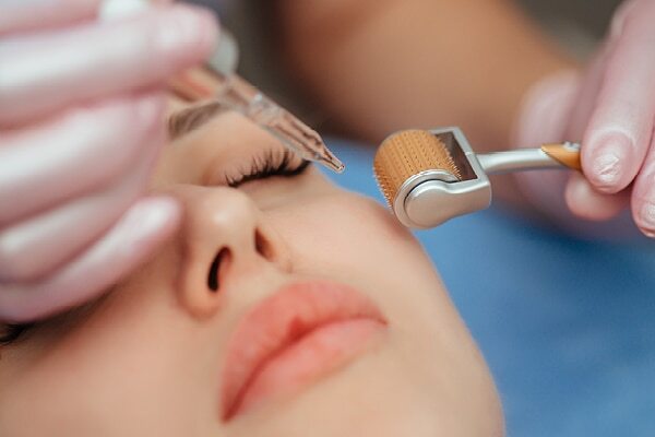 FAQs about dermaroller
