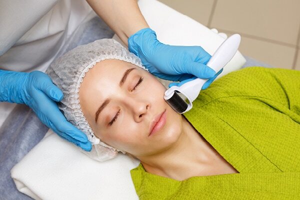 FAQs about dermaroller