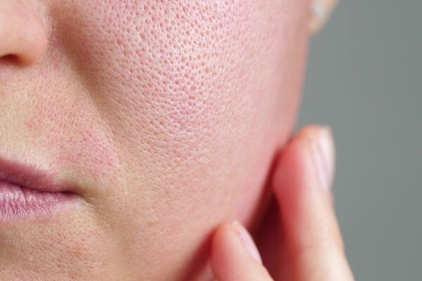 Are There Any Risks Associated with Using Carrot Seed Oil For Skin?