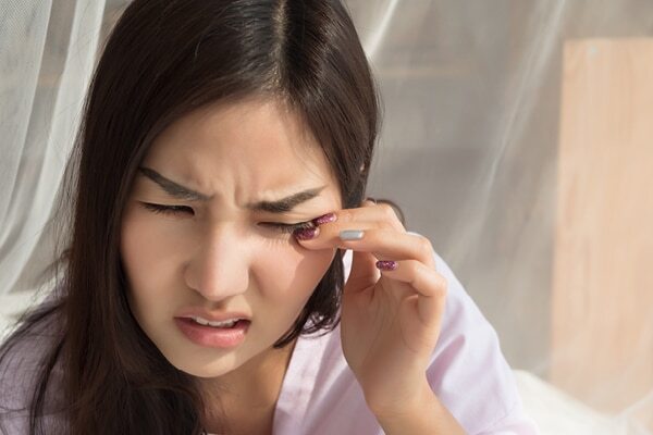 FAQ on Home Remedies for Styes on Eyes