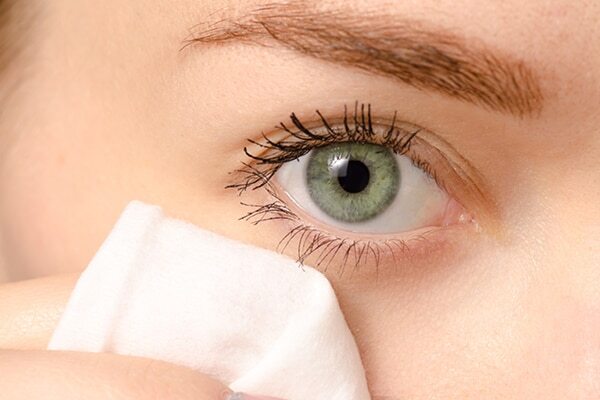 FAQ on Home Remedies for Styes on Eyes