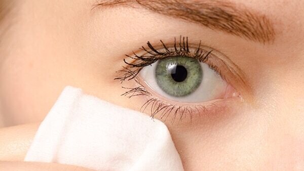 FAQ on Home Remedies for Styes on Eyes