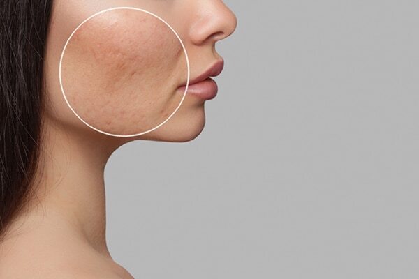FAQs about white spots on face