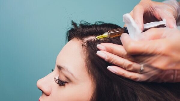 FAQs about alopecia treatment